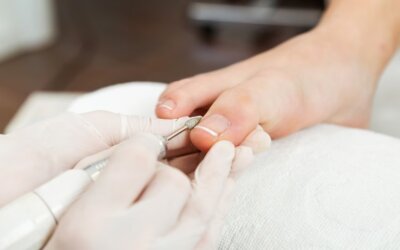 Oncologisch medisch pedicure